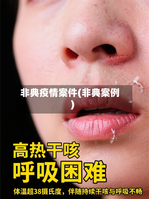 非典疫情案件(非典案例)-第1张图片