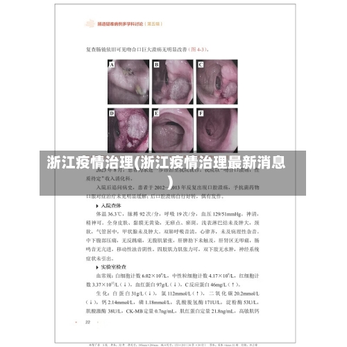 浙江疫情治理(浙江疫情治理最新消息)-第2张图片