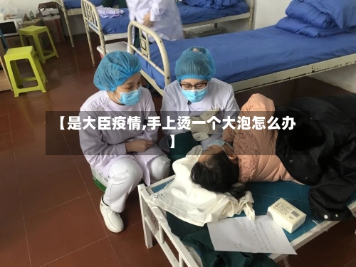 【是大臣疫情,手上烫一个大泡怎么办】-第3张图片