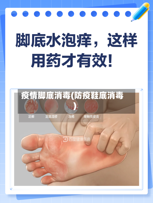 疫情脚底消毒(防疫鞋底消毒)-第2张图片